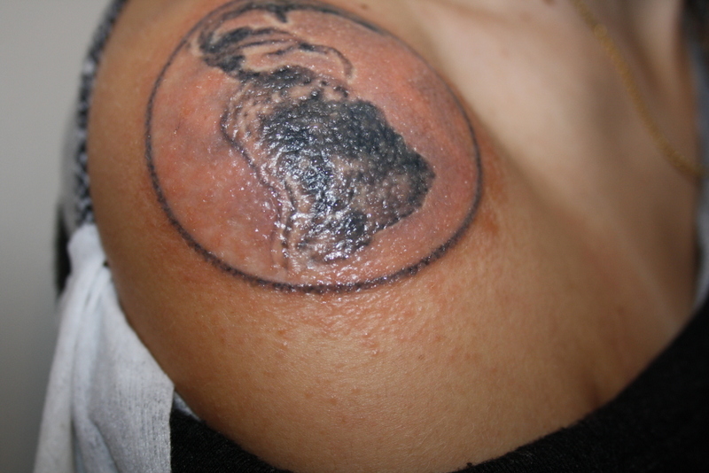 Wundwasser, Bläschen, Ausschlag nach 9 Tagen Was tun? Tattoo