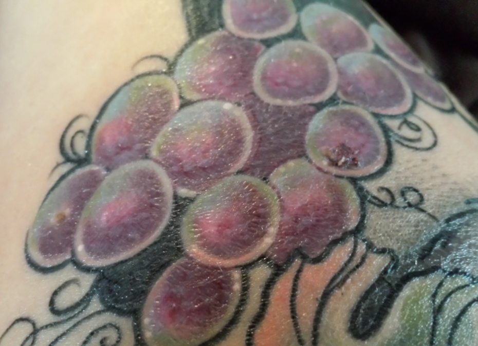Farbe nach Pellen TattooBewertung.de