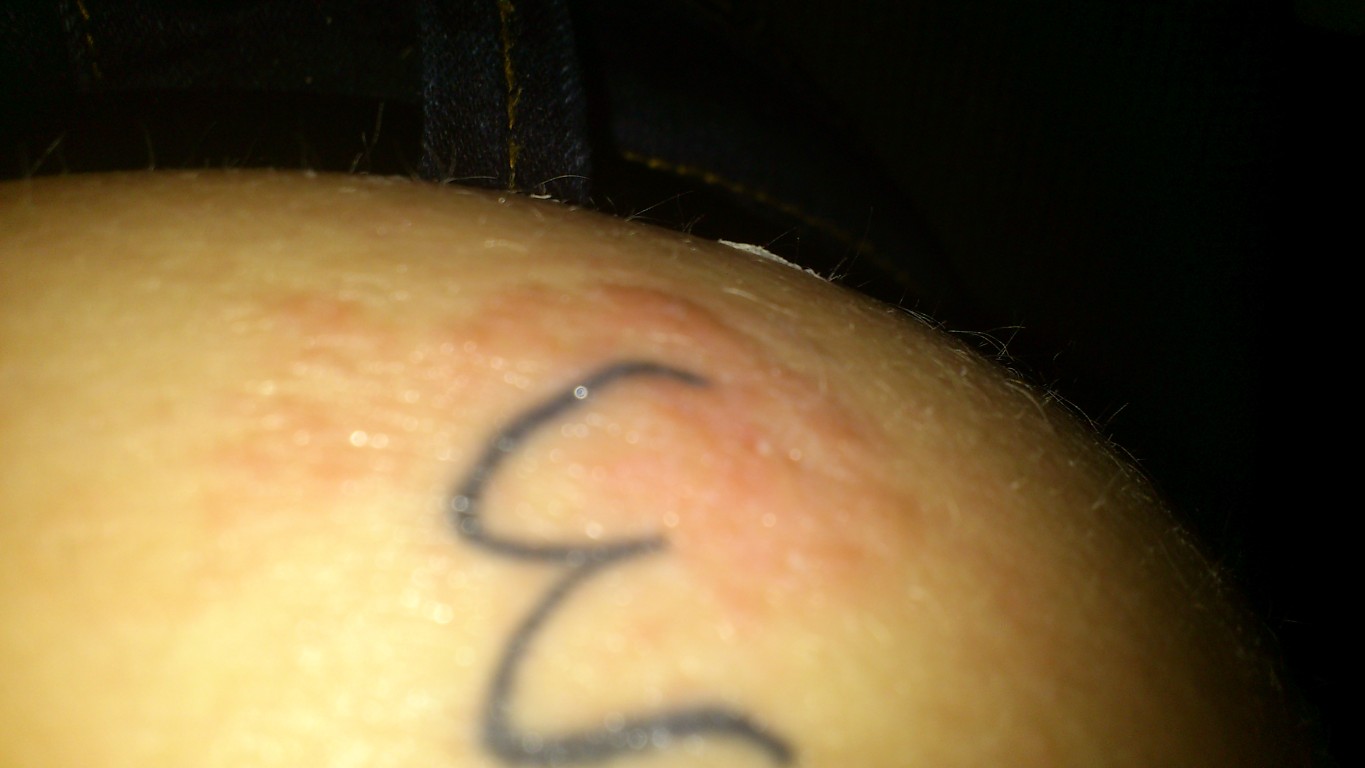 Rot Dick Juckt Tattoo Bewertung De