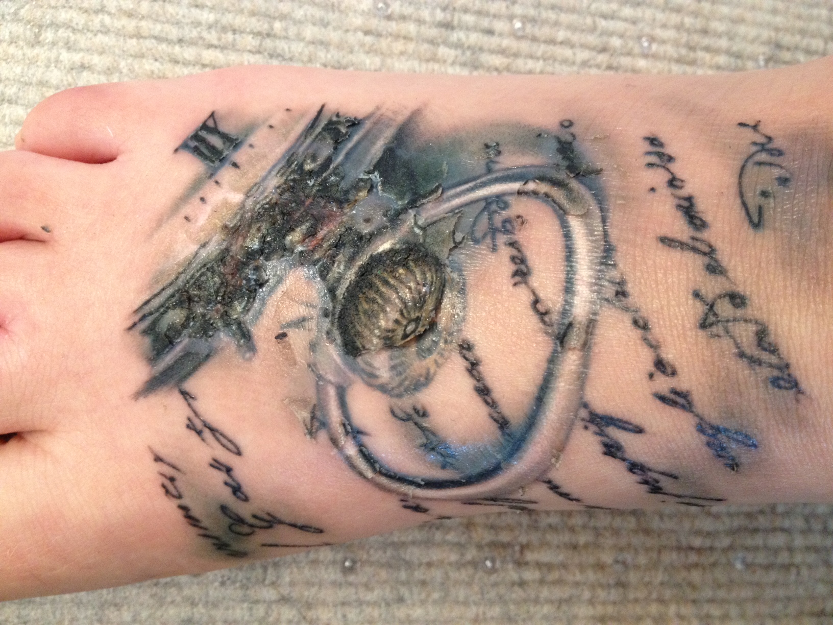 Autsch&hellip; Tattoo heilt nicht richtig . TattooBewertung.de