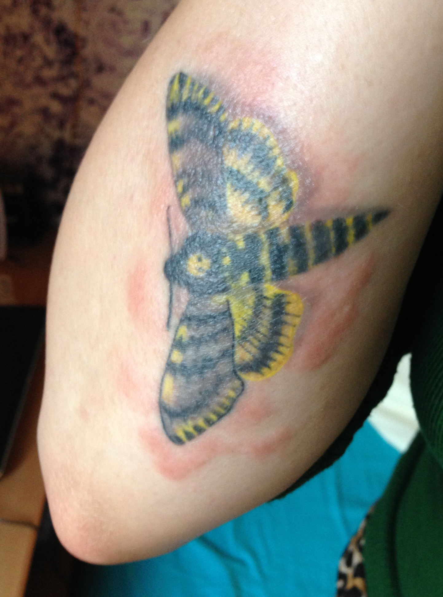 Ausschlag? Allergische Reaktion? TattooBewertung.de