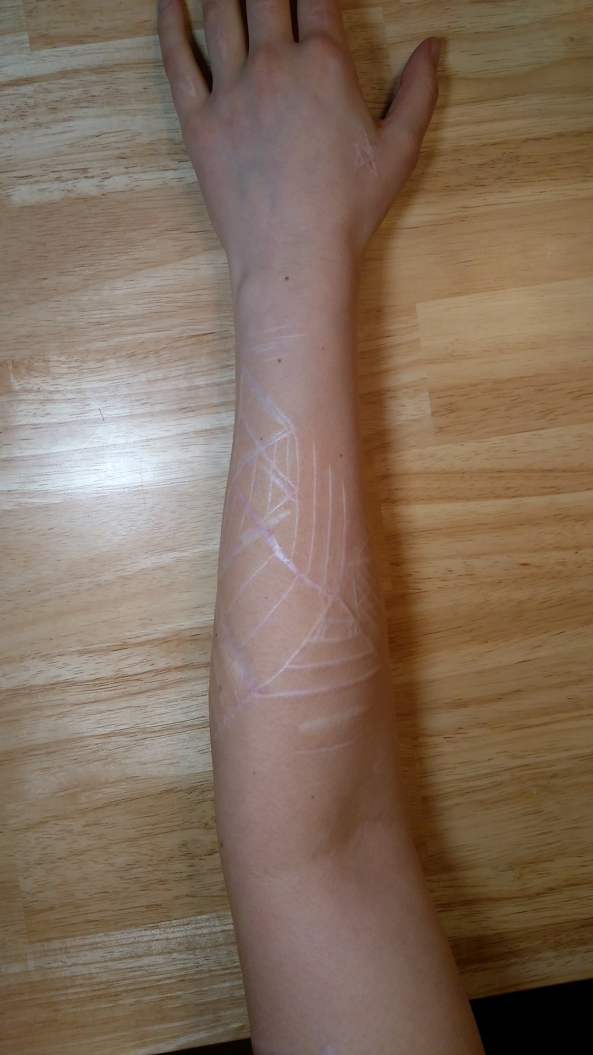 Tattoo &amp; Tiefe Narben&hellip;Rat &amp; Empfehlungen von Euch TattooBewertung.de