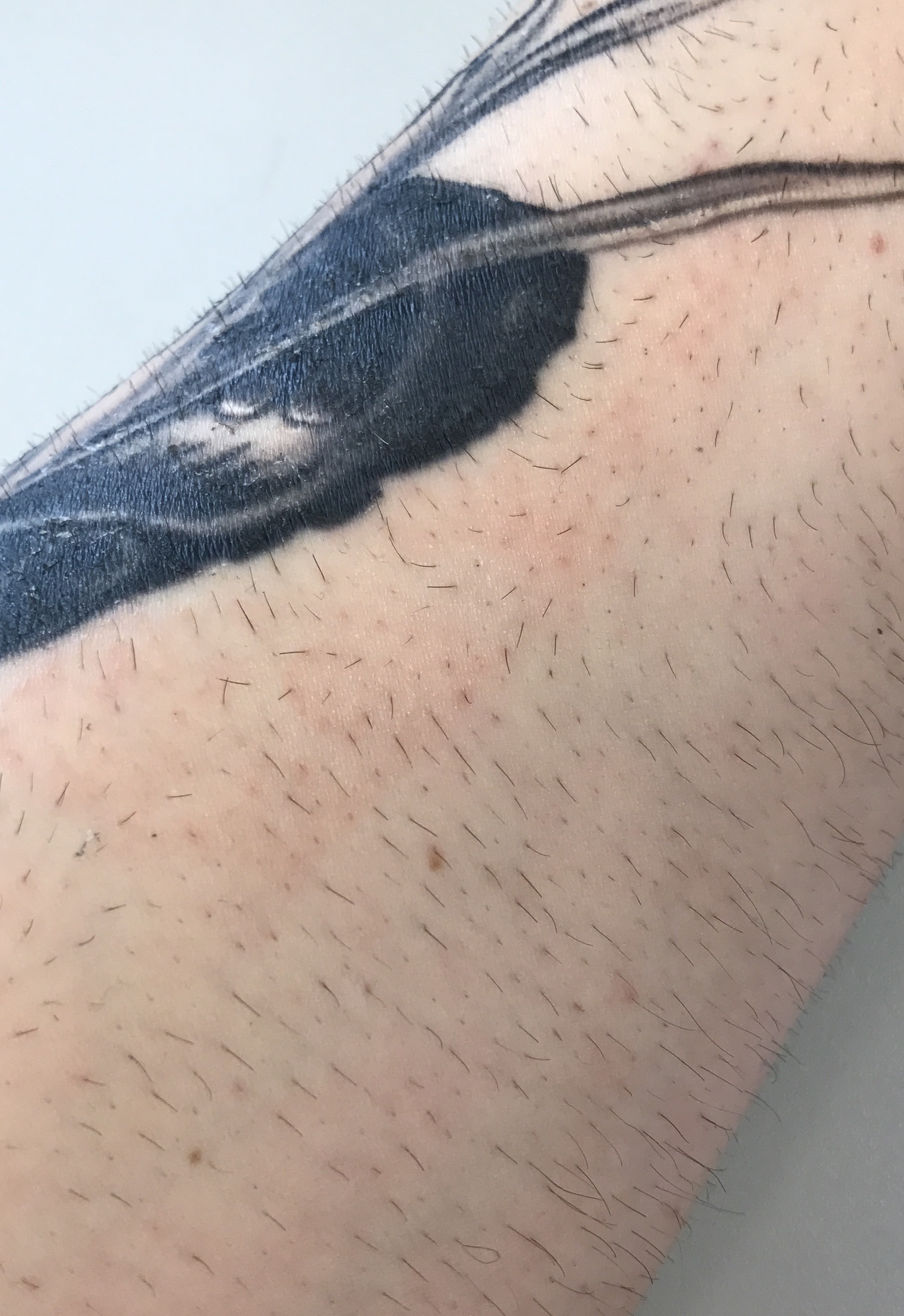 Reaktion auf Tattomed Gel? TattooBewertung.de