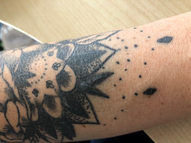 Tattoo vernarbt lag es an der Tättowiererin? TattooBewertung.de