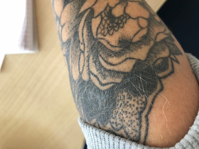 Tattoo vernarbt lag es an der Tättowiererin? TattooBewertung.de