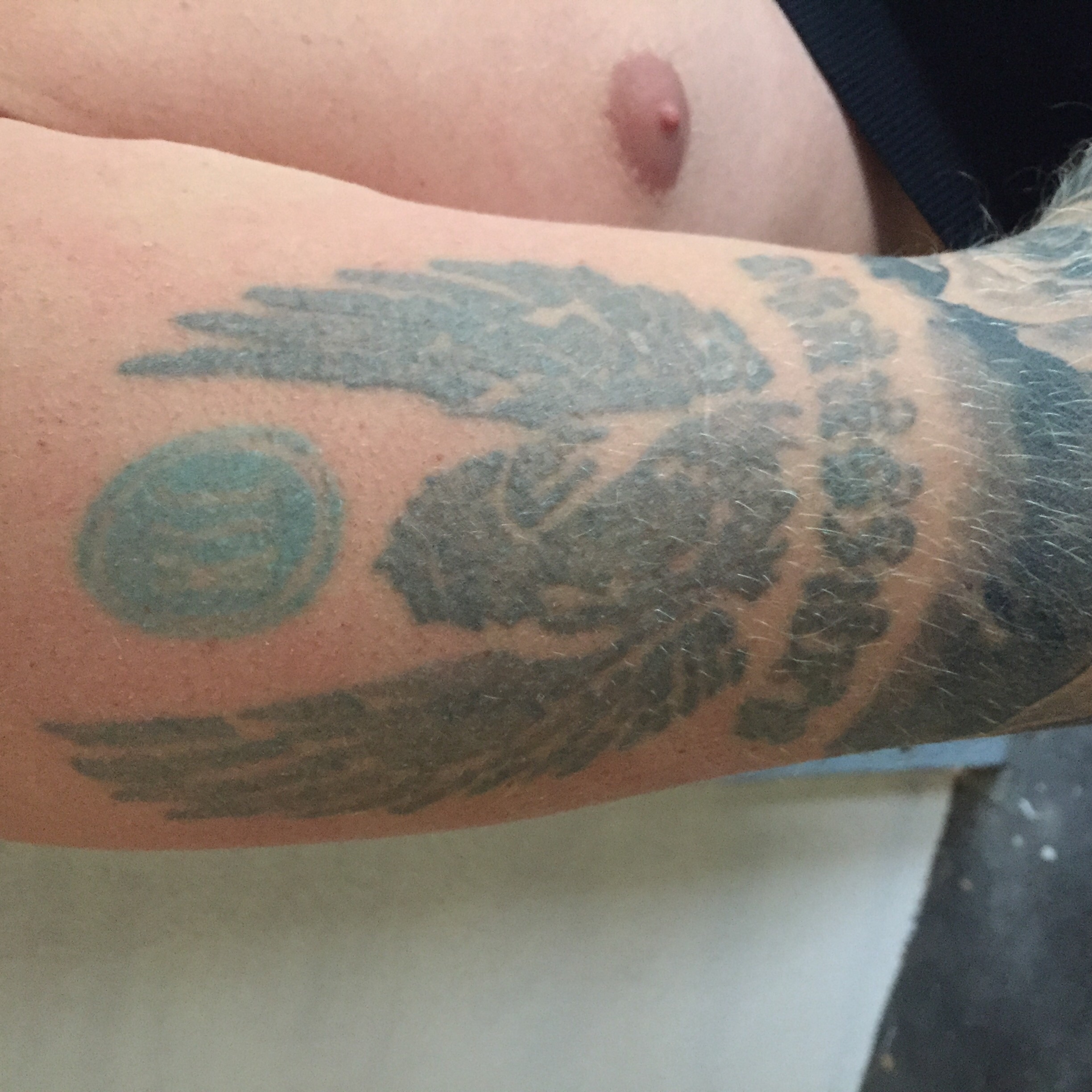 Hilfe!!! Suche einen Cover up Spezialisten in Baden Württemberg. Komme