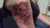 arm