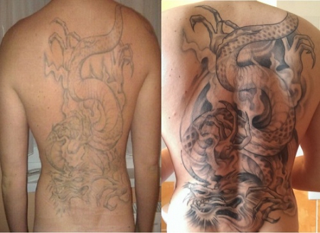 Rücken Cover UP