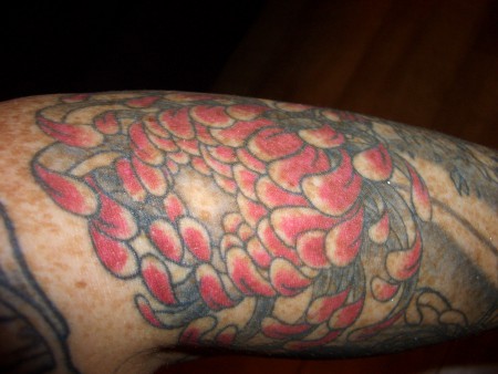 mein Arm...