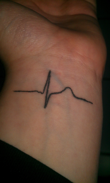 EKG