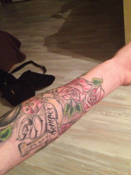 Mein neuer Unterarm