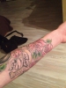 Mein neuer Unterarm