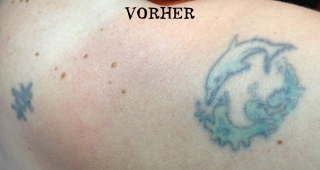 Cover Up