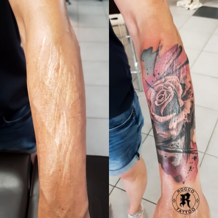 Colour tattoo (Narben)