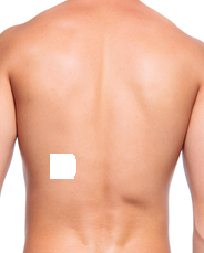 MallonyBellony: Narbe überdecken, Stelle schwierig, brauche Anregungen