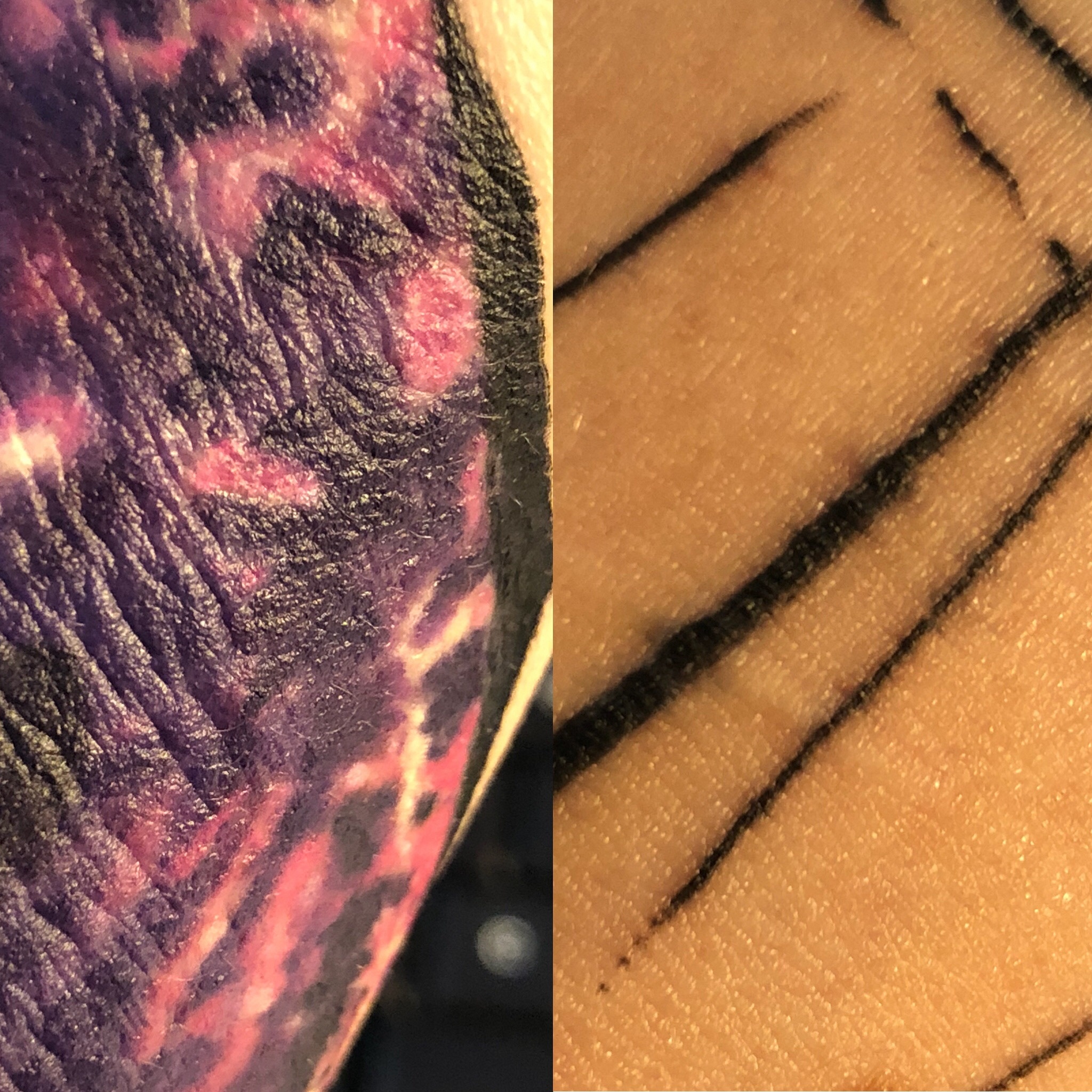 Babouche: Probleme mit frischem Tattoo