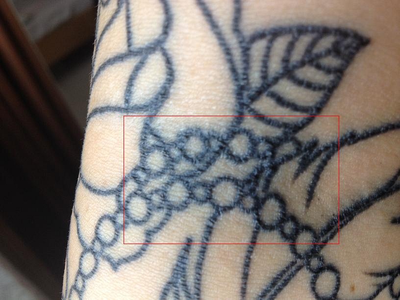 _kitty_: Problemhaut..?