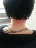 kaha41: was ist es? allergische Reaktion?