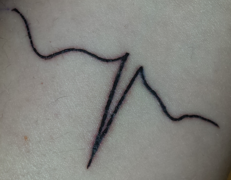 immerdieseBenut...: Tattoo pellt und ist rot