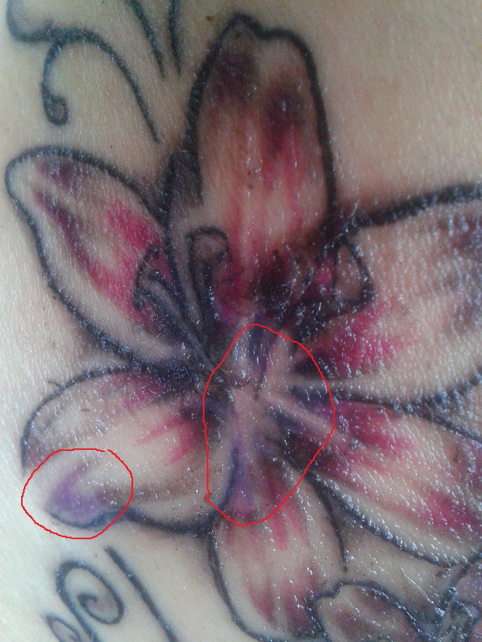 ..Jenny..: Tattoo hat dicke Kruste und Farbe geht weg. Bitte helft mir!