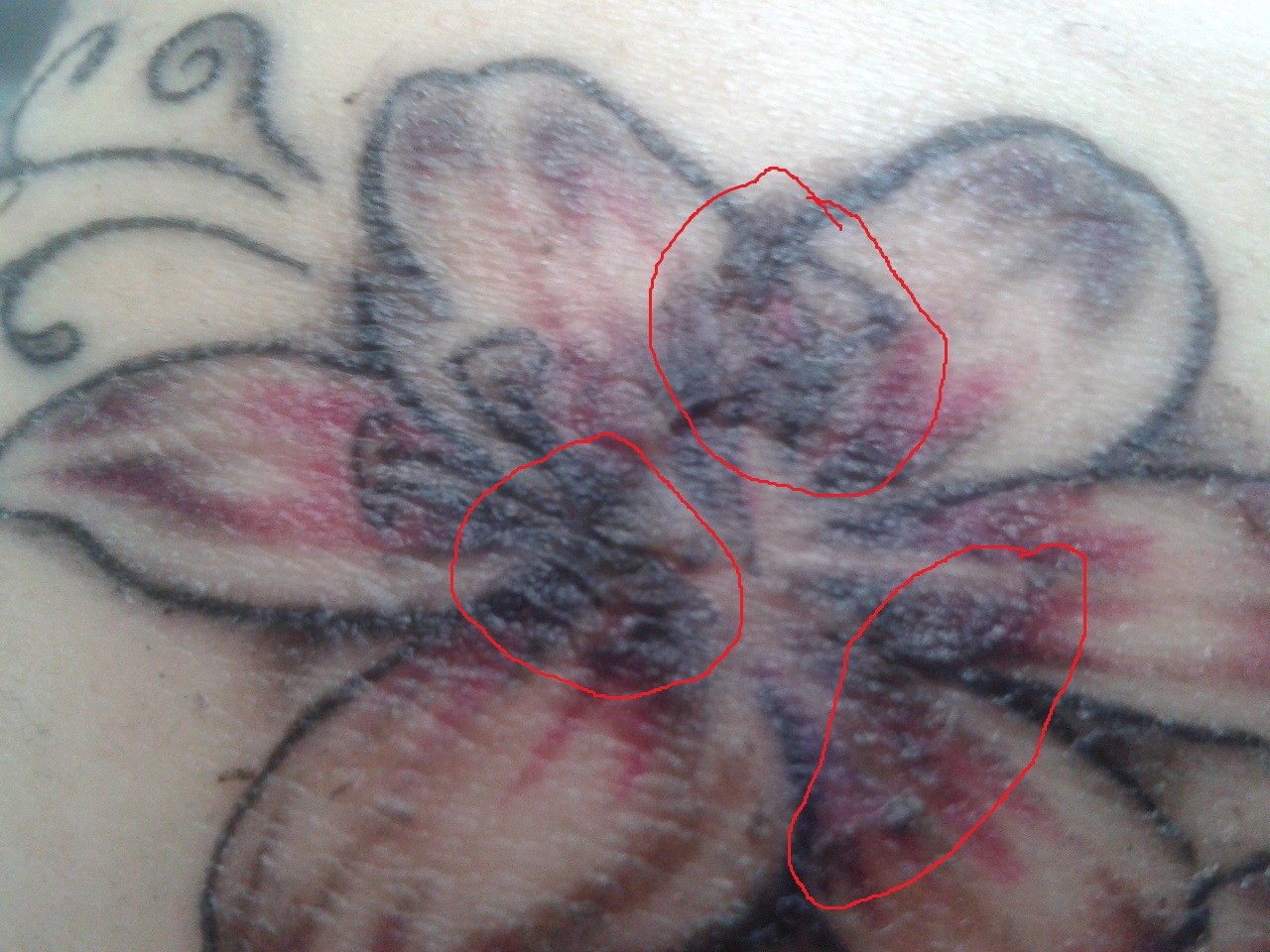 ..Jenny..: Tattoo hat dicke Kruste und Farbe geht weg. Bitte helft mir!