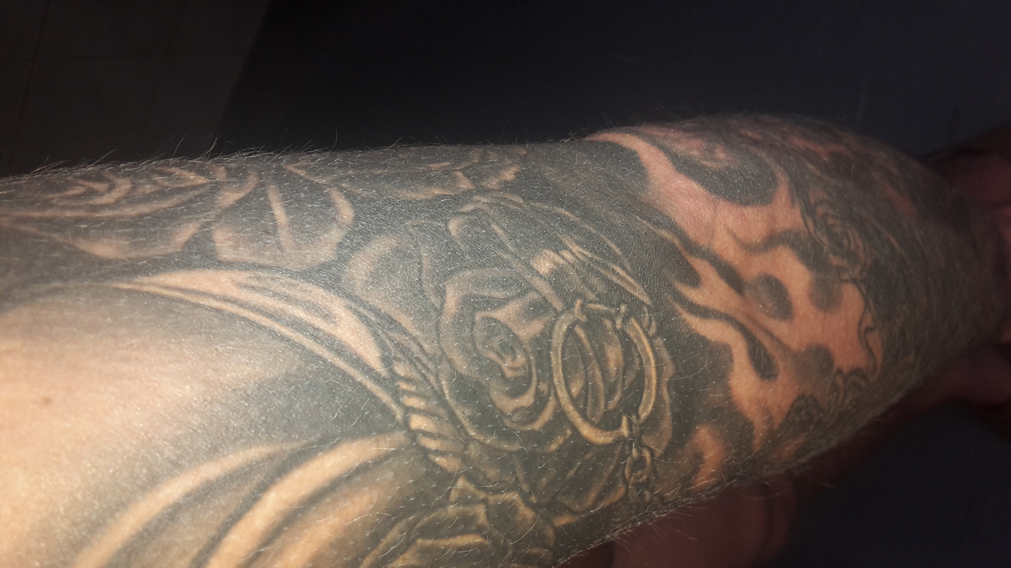 üpsder: viel zu dunkle tattoos. was kann man machen?