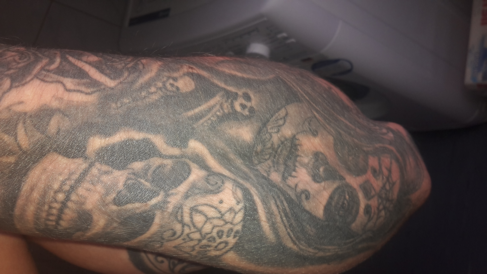 üpsder: viel zu dunkle tattoos. was kann man machen?