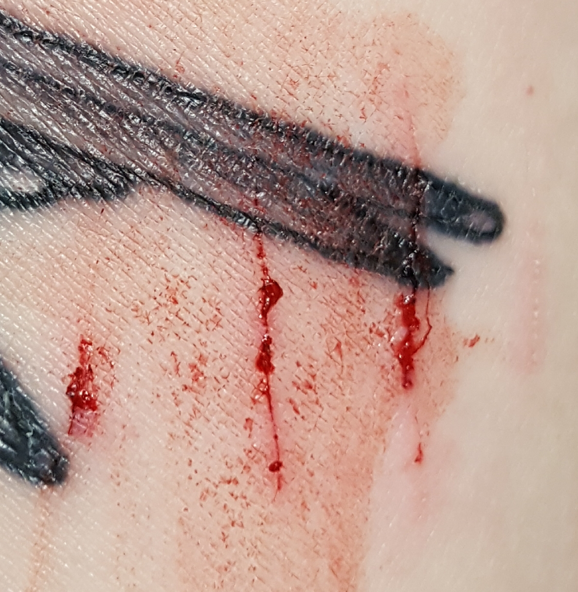 Bulli84: Am frischen Tattoo aufgekratzt