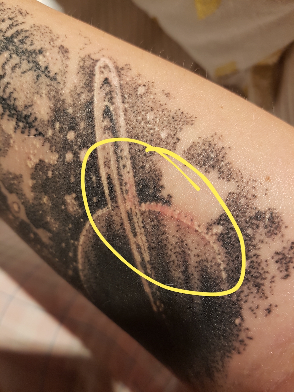 Mascha2019: Stelle am Tattoo nach über 3 Wochen noch immer nicht verheilt/rot/leichter Grind