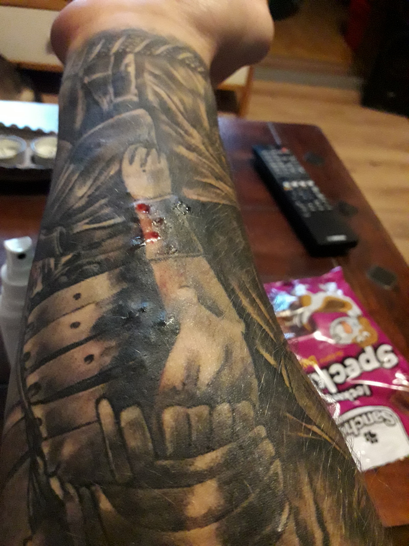 Ragnar: Tattoo hat Blasen .Allergie ? 
