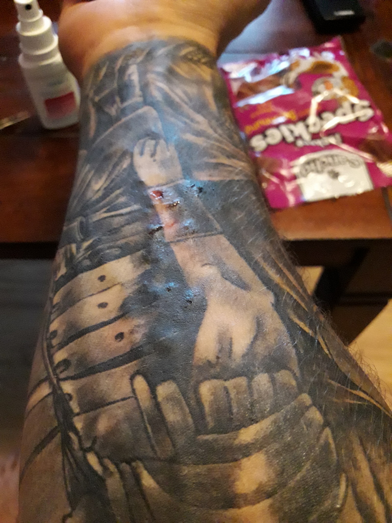 Tattoo Hat Blasen Allergie Tattoo Bewertung De
