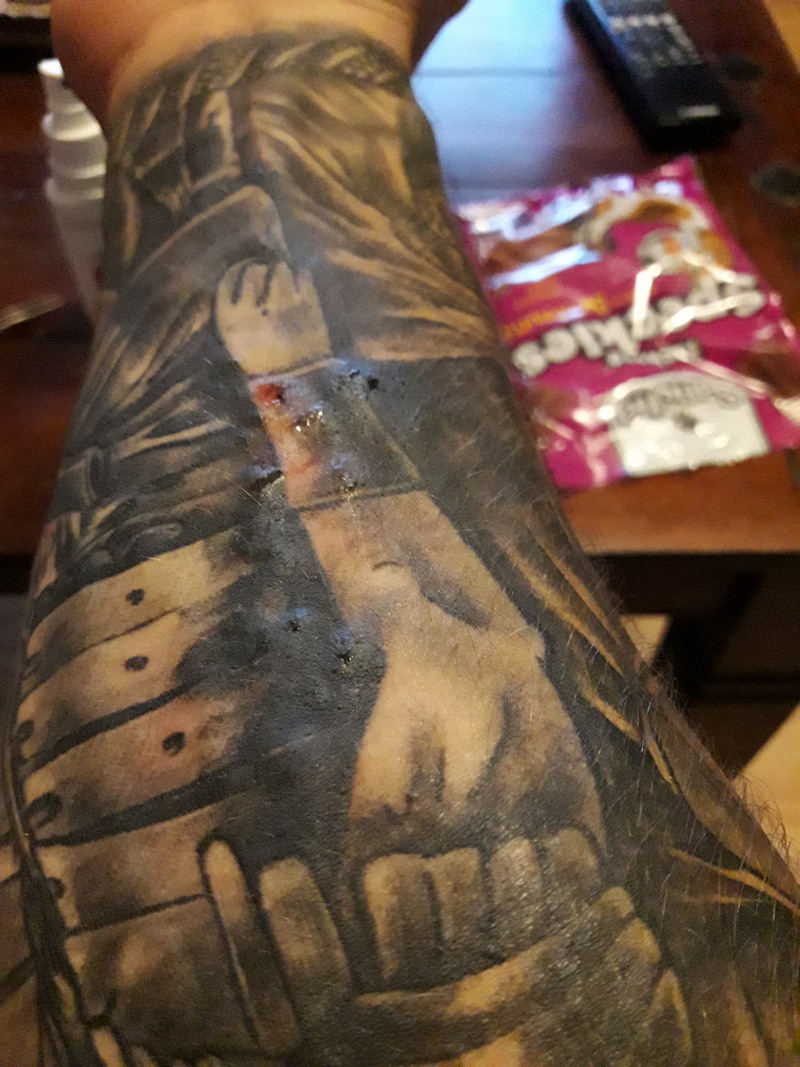 Ragnar: Tattoo hat Blasen .Allergie ? 