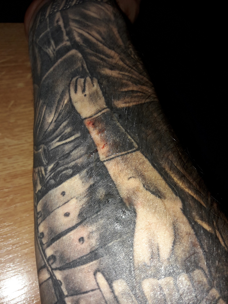 Ragnar: Tattoo hat Blasen .Allergie ? 