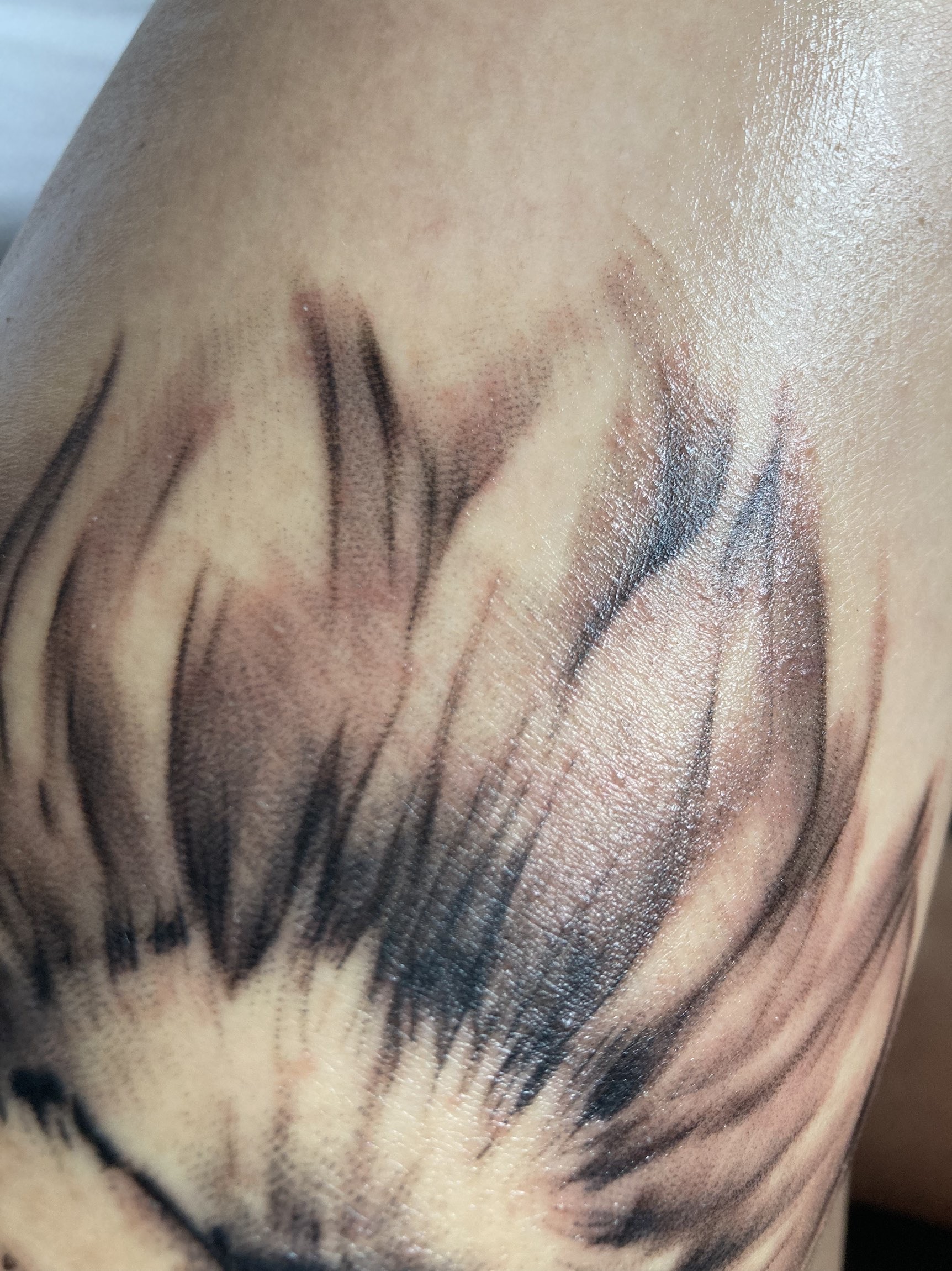 KäpseleXx: Hilfe! Pusteln auf Tattoo - was könnte das sein? Erfahrungen?