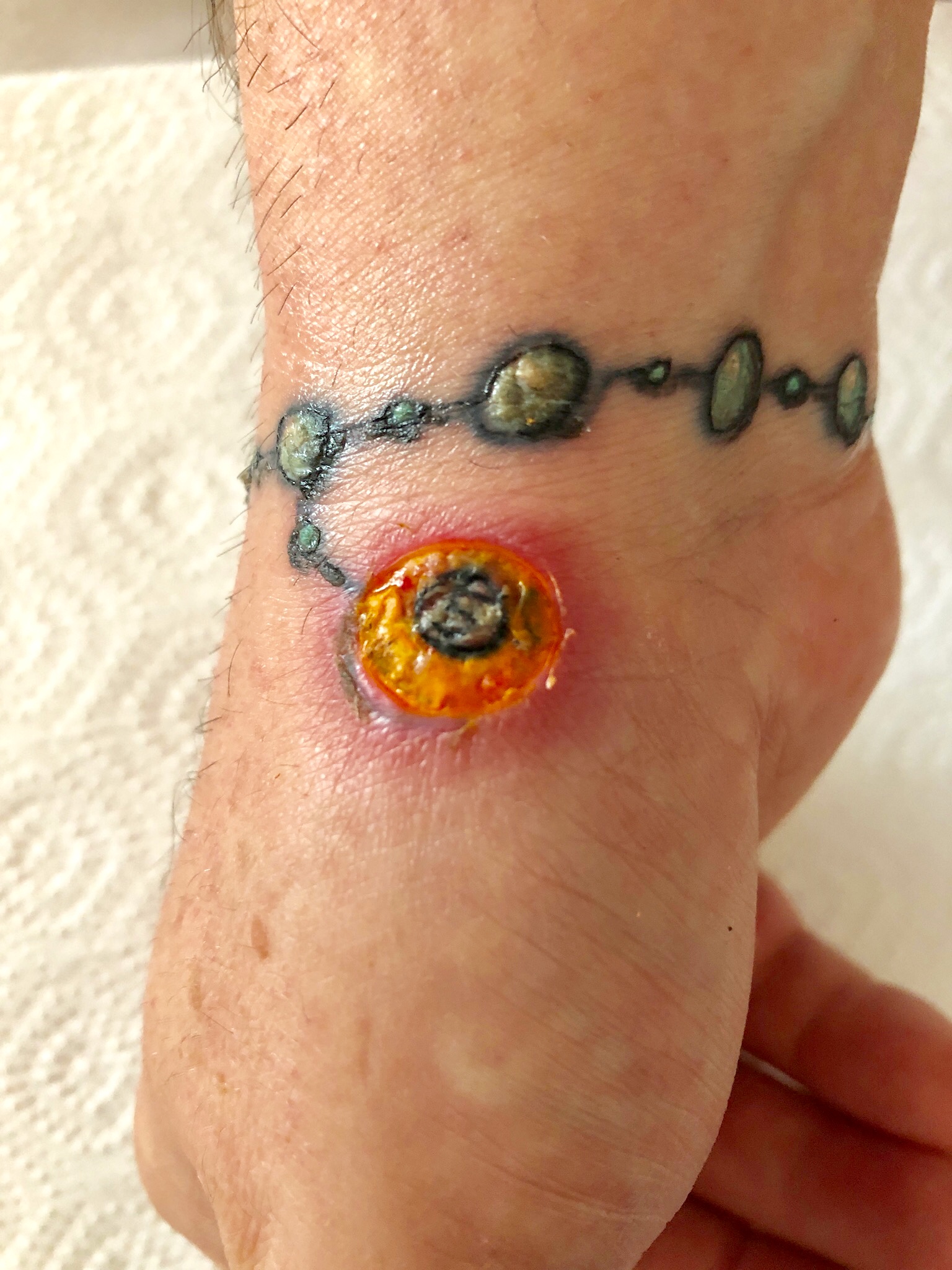 FrankyM: Ich bekomme grade Angst