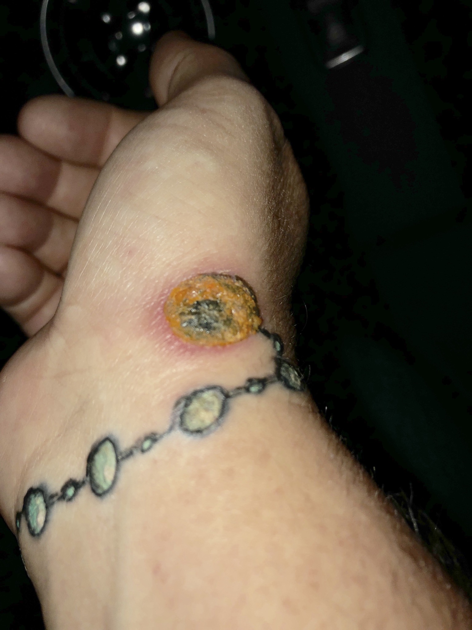 FrankyM: Ich bekomme grade Angst