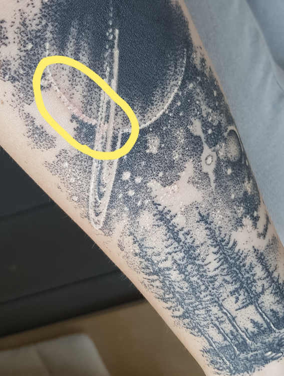 Mascha2019: Stelle am Tattoo nach über 3 Wochen noch immer nicht verheilt/rot/leichter Grind