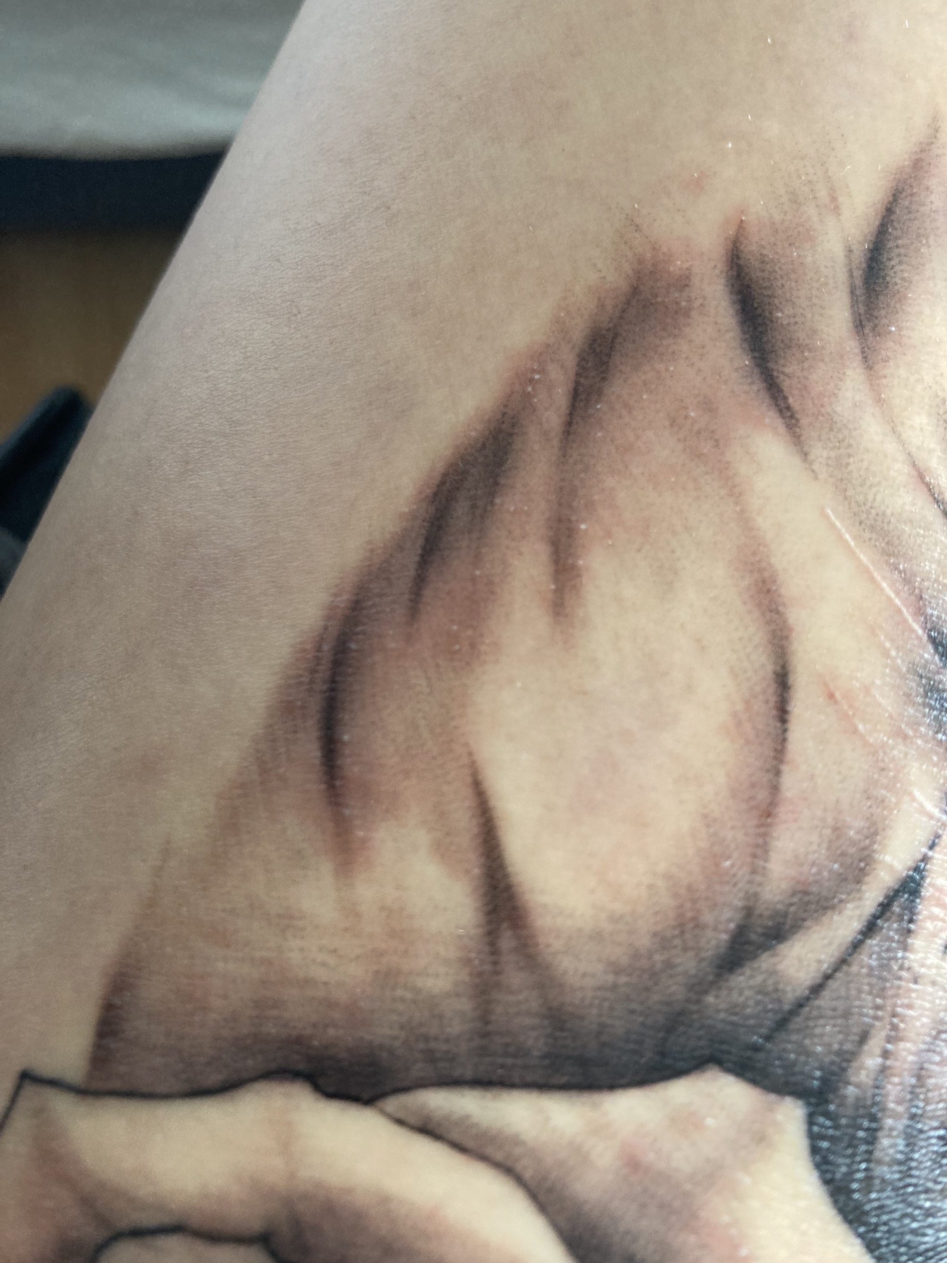 KäpseleXx: Hilfe! Pusteln auf Tattoo - was könnte das sein? Erfahrungen?