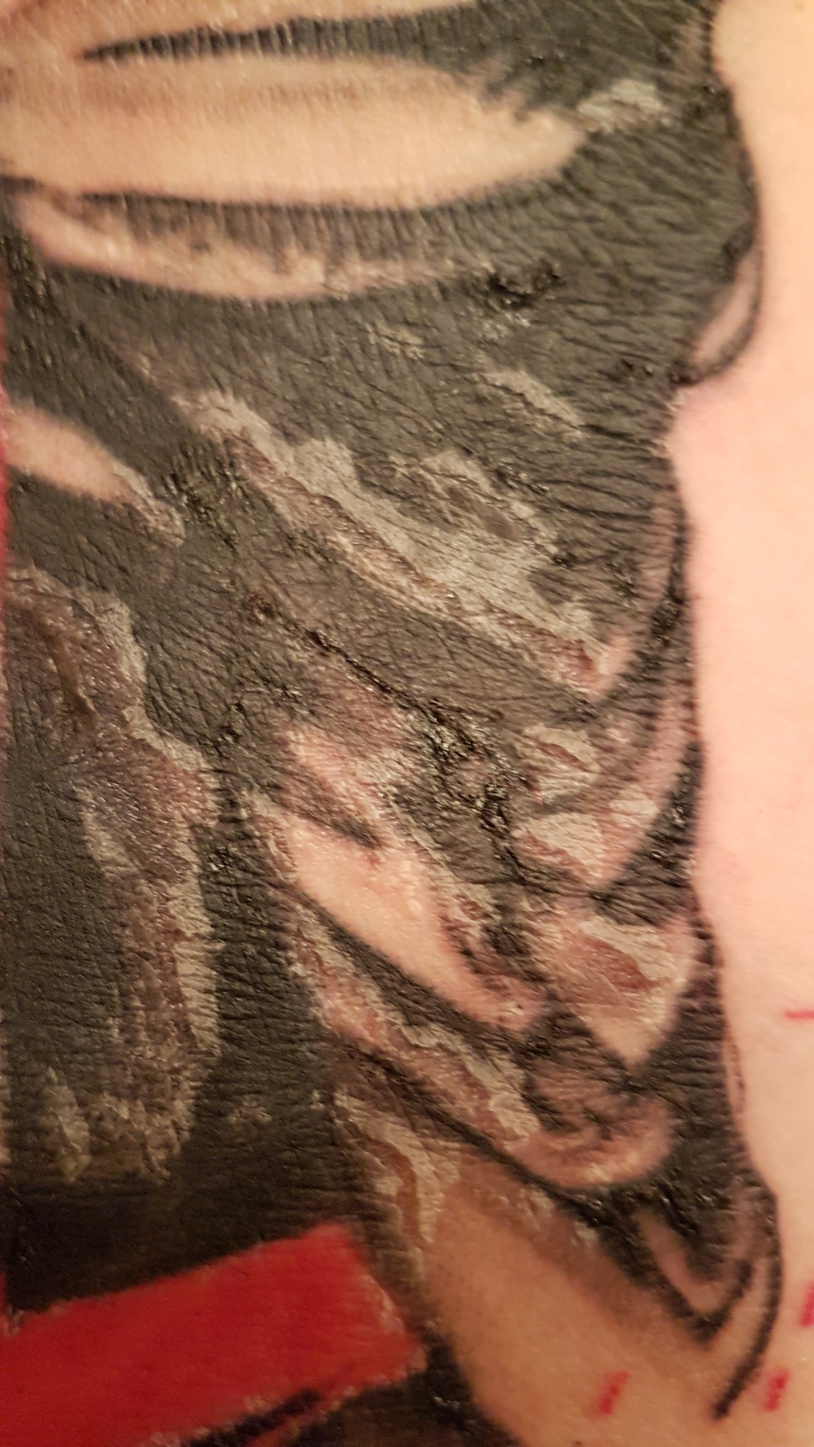 Leviathan72: Abheilungsprozess