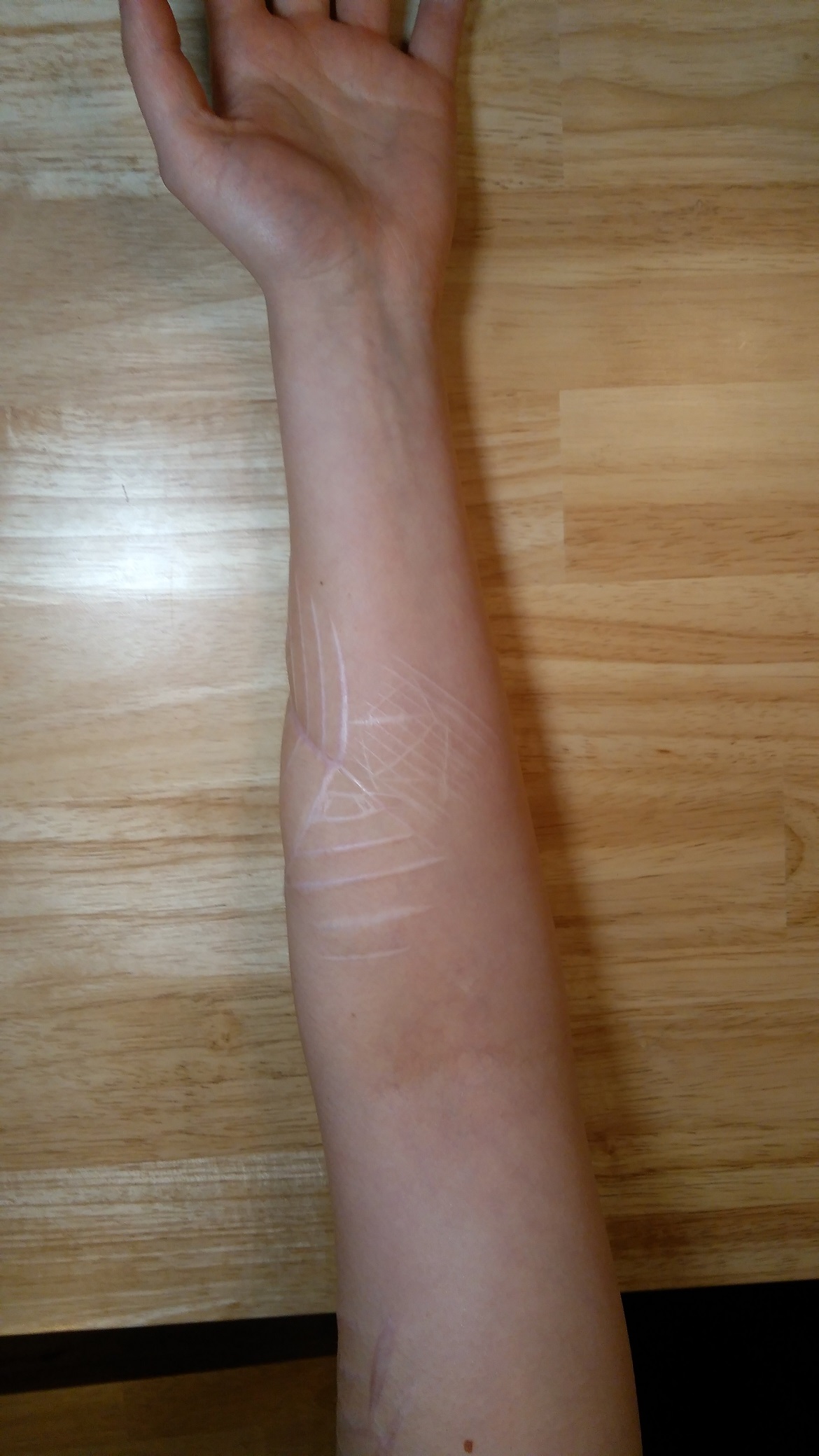 Tattoo &amp; Tiefe Narben&hellip;Rat &amp; Empfehlungen von Euch TattooBewertung.de