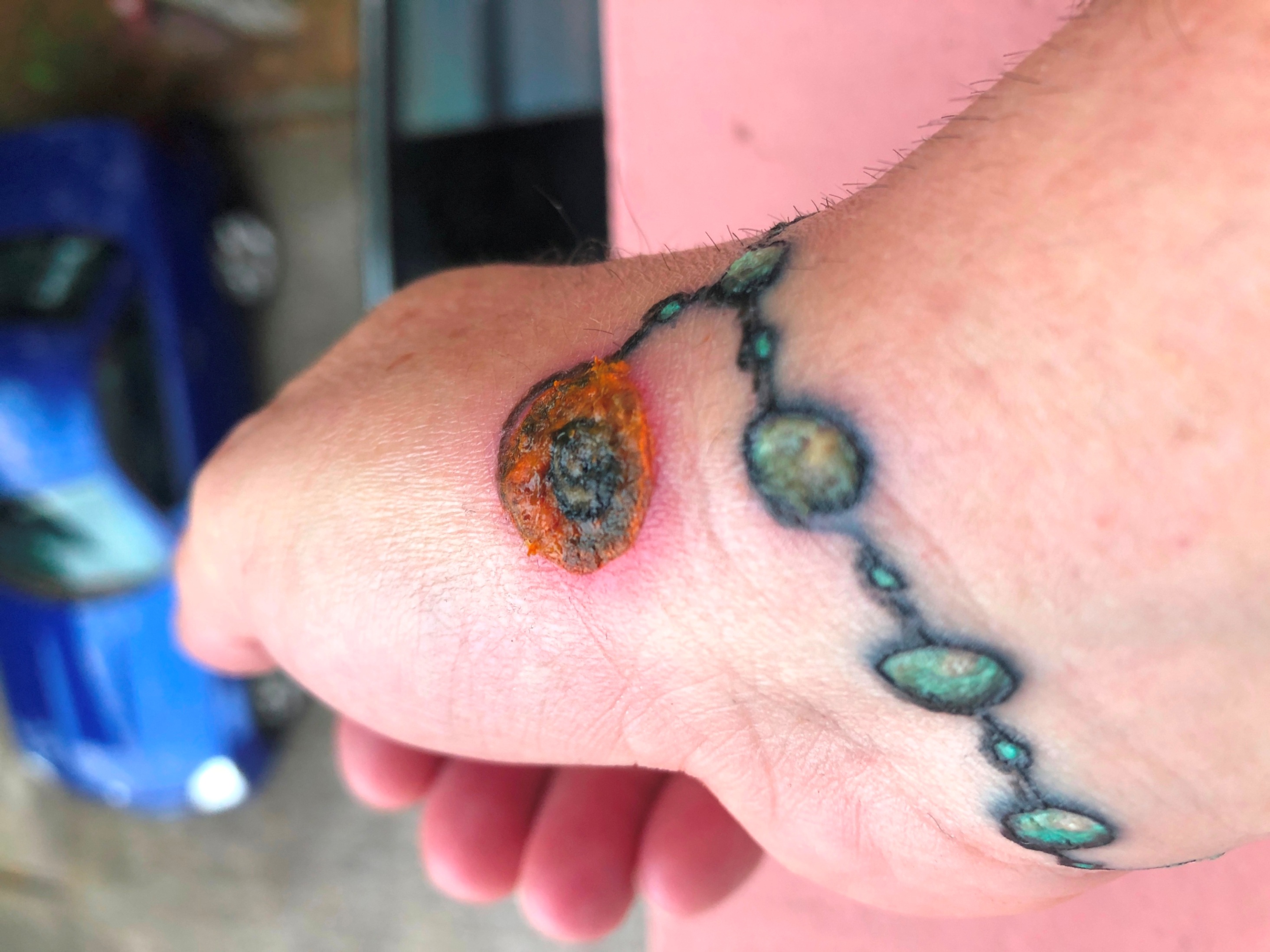 FrankyM: Ich bekomme grade Angst