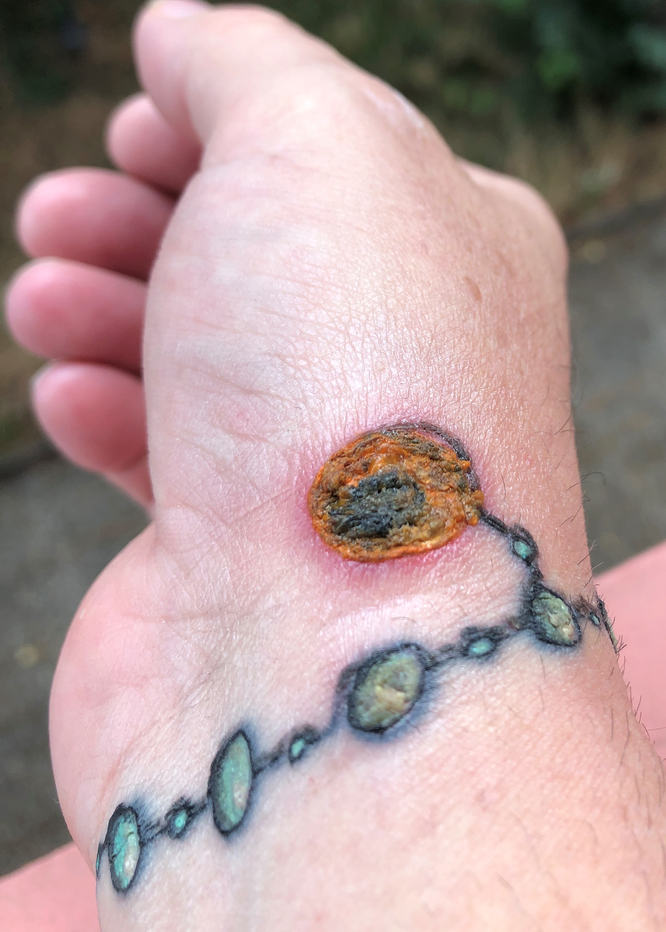 FrankyM: Ich bekomme grade Angst