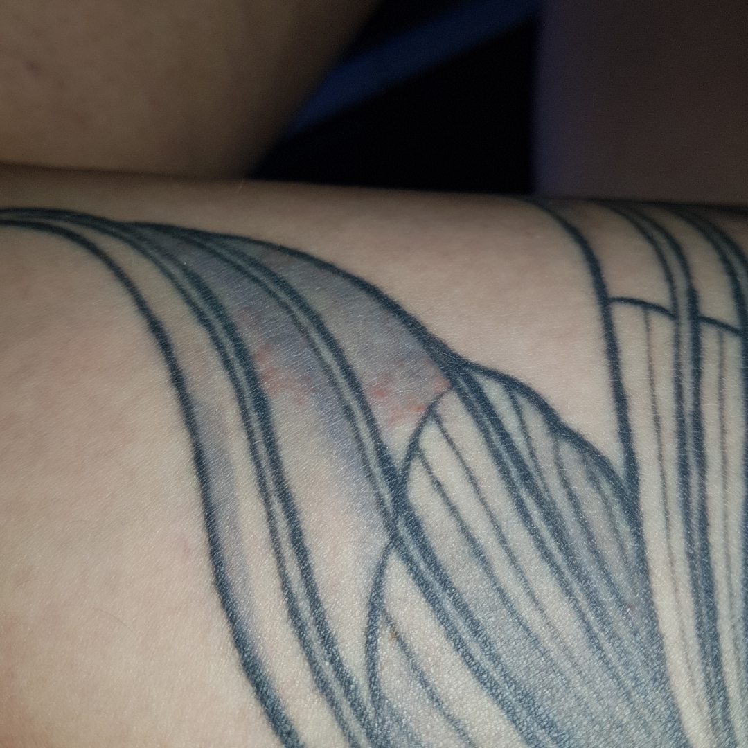 Marieczm: Allergie? Zum ersten Mal nach zig Tattoos?