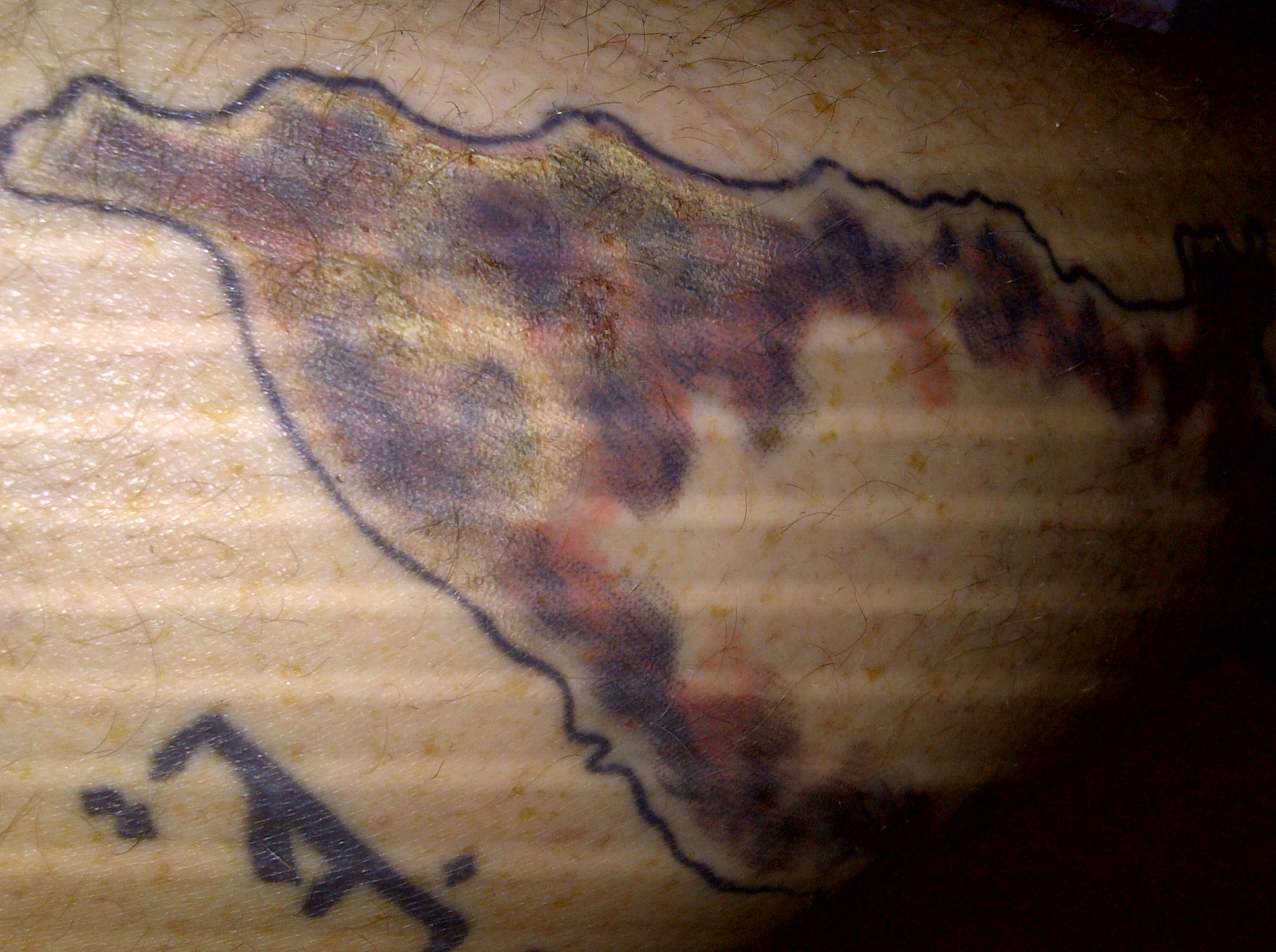 dayindayout: Blut und taubes Bein nach Tattoo