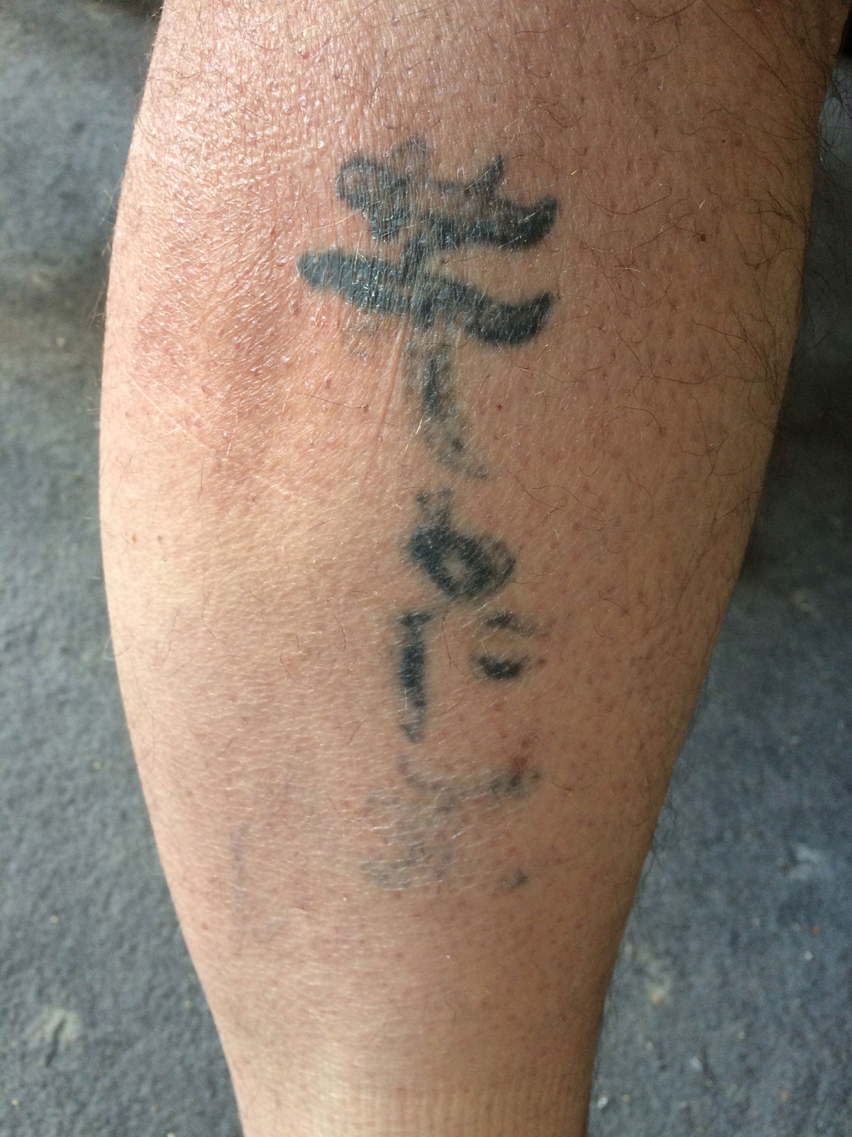 RobertK: Tattoo-Unfall auffrischen